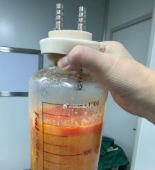 保山水动力吸脂手术要做多久？